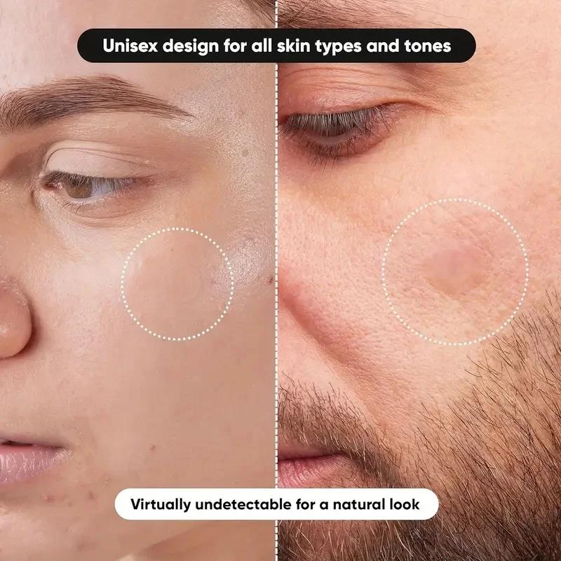 360 قطعة/صندوق رقع حب الشباب - - مراجعة Essential Oils وسعره
